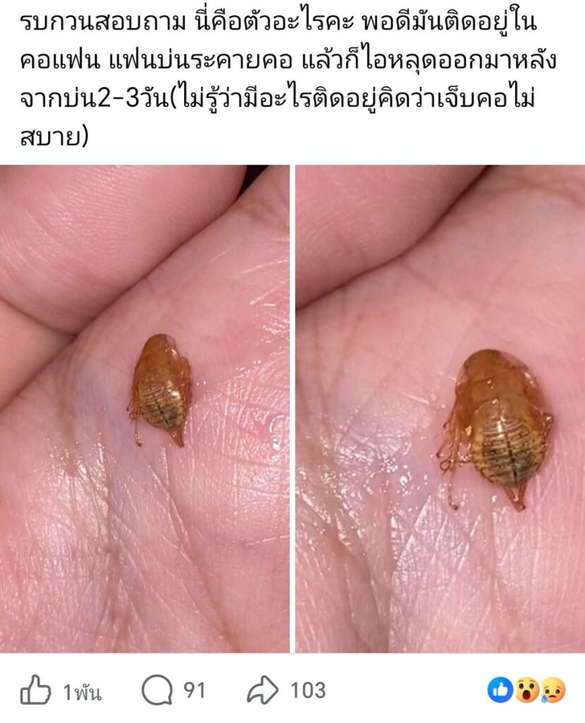 ไวรัล แมลงสาบติดคอ แฟนสาวแชร์อุทาหรณ์ไอหลุดออกมาหลังระคายคอ 3 วัน